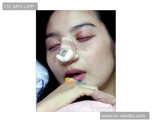 窦加星社媒分享鼻梁骨折手术后因疲惫引发哮喘的恢复经历与反思